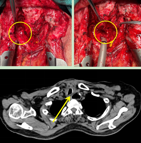 from clipboard from clipboard